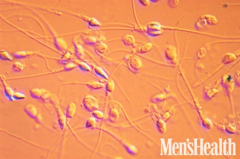 Rumena sperma kot prvi znak.  (foto: Arhiv)