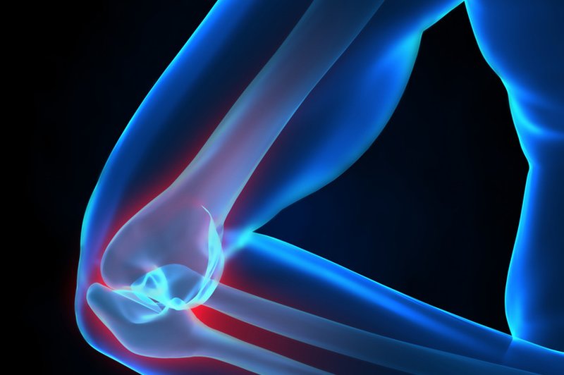 Tekaško koleno je eno od  najpogostejših poškodb pri tekačih.  (foto: Shutterstock.com)