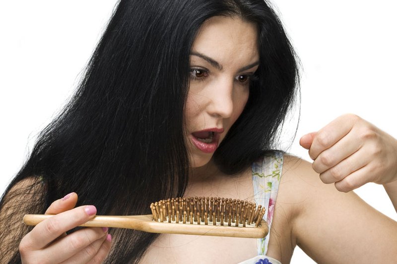 Izpadanje las (foto: Shutterstock.com)
