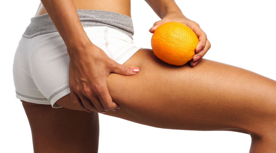 Celulit – večni sopotnik? (foto: Shutterstock.com)
