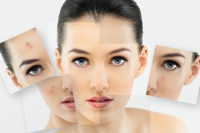 Kdaj po nasvet k dermatologu? (foto: Shutterstock.com)