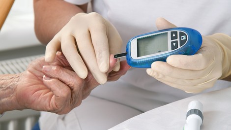 Strokovnjak svetuje: Diabetes in glivične okužbe