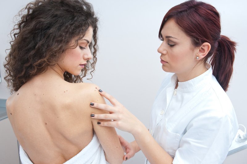 Preventivni pregled pri dermatologu (foto: Shutterstock.com)
