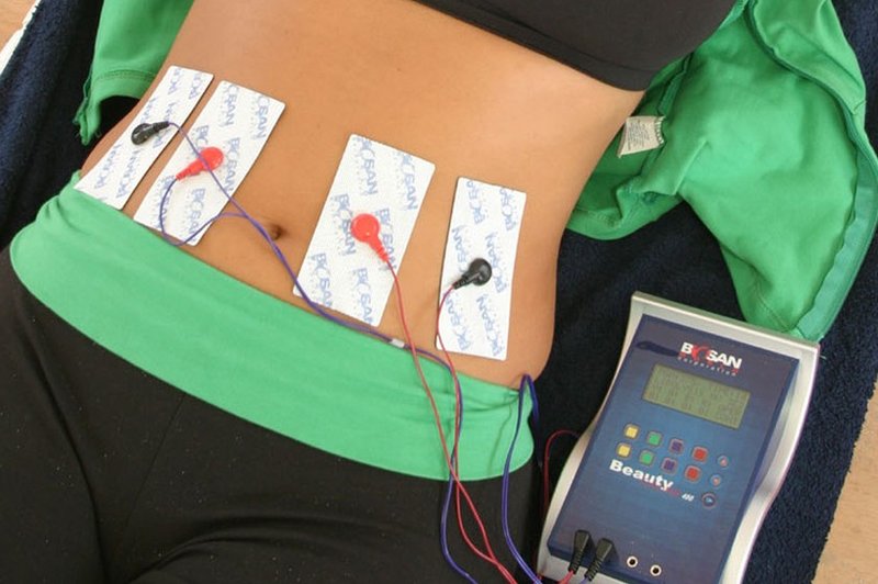 Kako učinkoviti so elektronski mišični stimulatorji?   (foto: Profimedia)