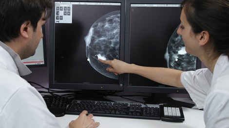 Potek in načini zdravljenja raka dojk