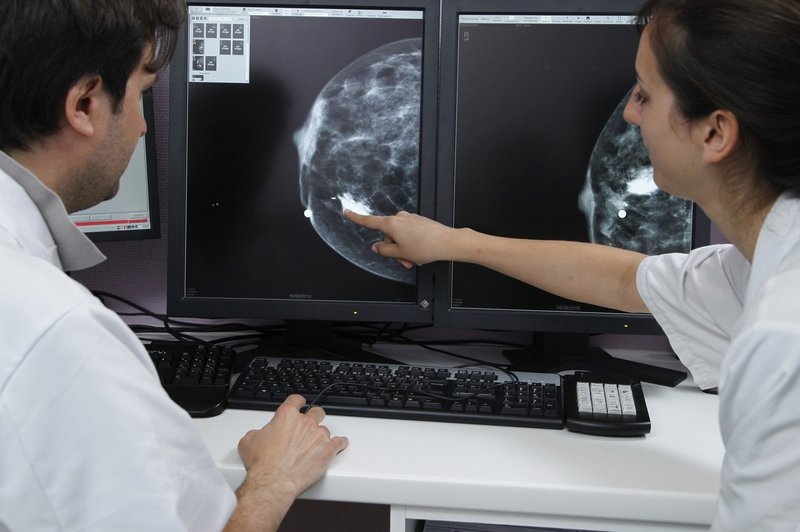 Potek in načini zdravljenja raka dojk (foto: Profimedia)