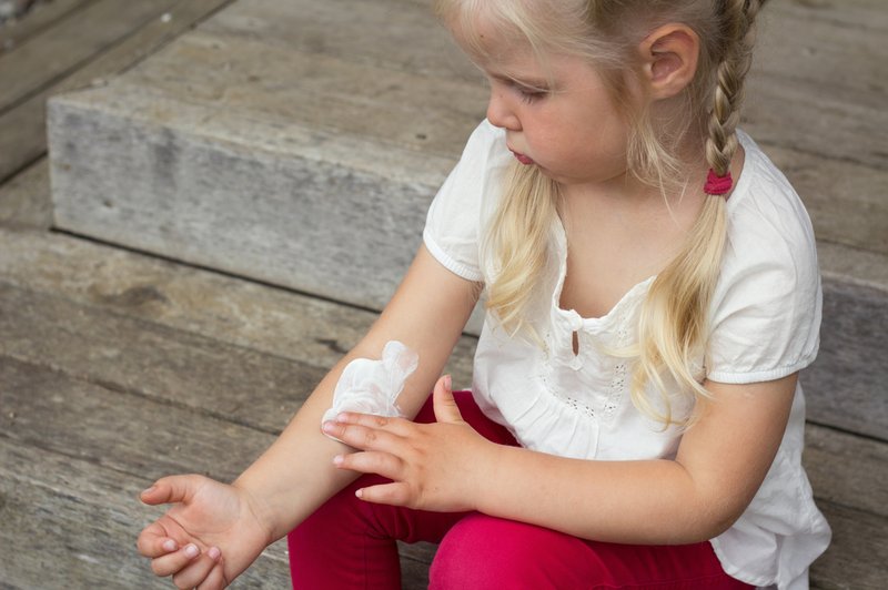 Zakaj pride do atopijskega dermatitisa? (foto: Shutterstock.com)