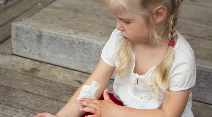 Zakaj pride do atopijskega dermatitisa? (foto: Shutterstock.com)