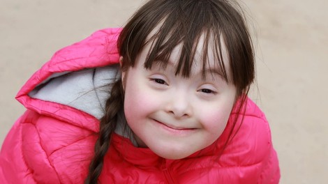 V Sloveniji je trenutno okoli 3000 oseb z Downovim sindromom