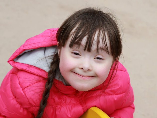 Najpomembejše značilnosti otrok z Downovim sindrom - Foto: Profimedia