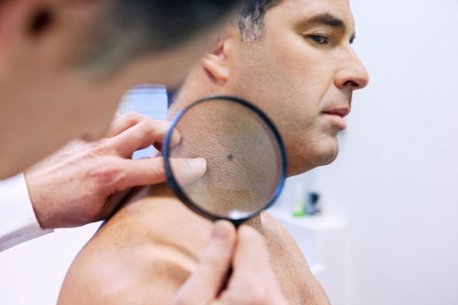 Opazujte svoja lepotna znamenja in odkrijte nepravilnosti