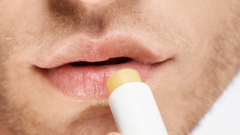 Ali lahko postanemo odvisni od balzama za ustnice?