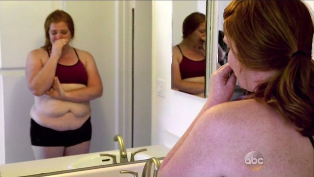 31-letna Amber je bila s svojim 113 kilogramov težkim telesom izjemno nezadovoljna. Tako zelo, da je zaradi tega pogosto jokala. …
