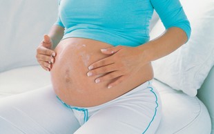 Na kaj morate biti še posebej pozorni pri negi v času nosečnosti