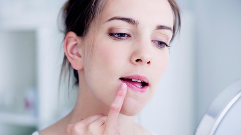 Preprost domač trik proti razpokanim ustnicam