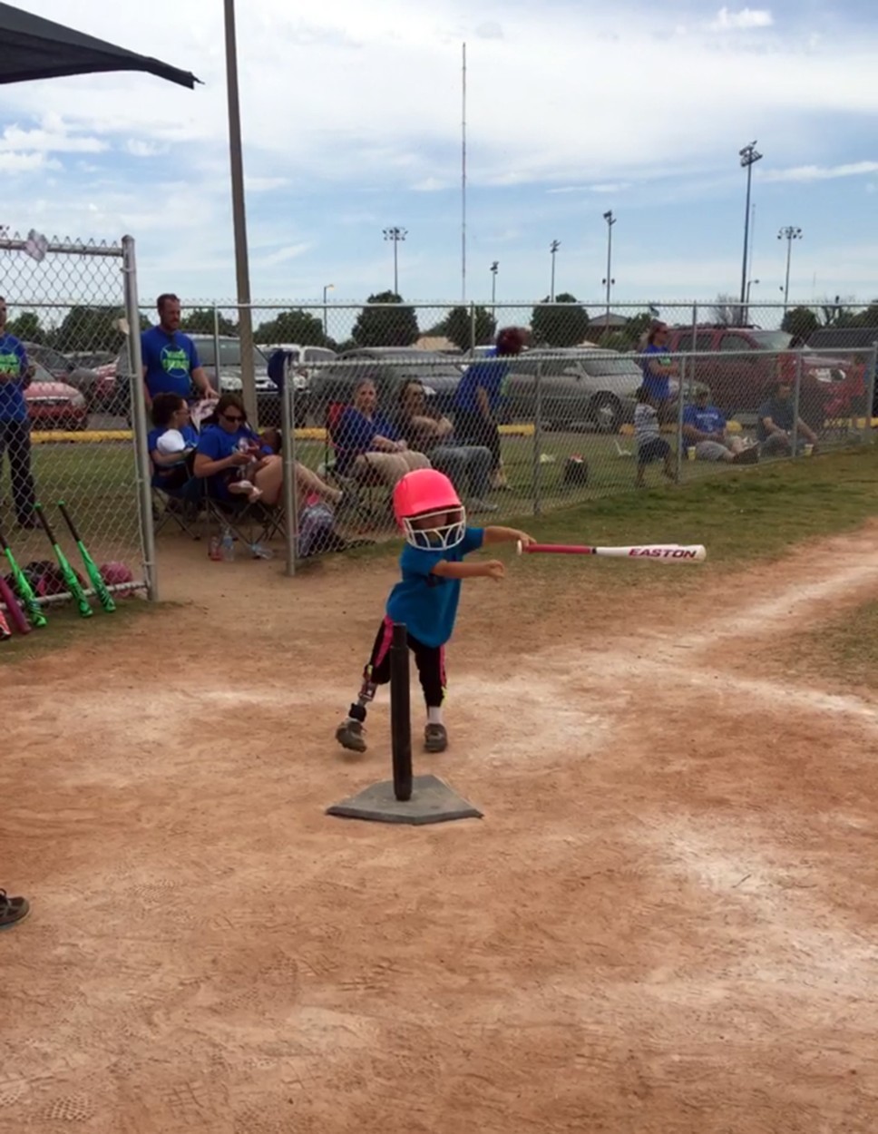 igra baseball ter druge fizično zahtevne športe. Prejšnji mesec je Jemma dobila protezo, ki se prepogiba v kolenu, kar ji …