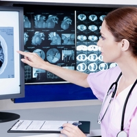 Od nihanja razpoloženja do glavobolov: 7 simptomov, ki lahko opozarjajo na možganski tumor