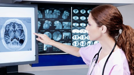 Od nihanja razpoloženja do glavobolov: 7 simptomov, ki lahko opozarjajo na možganski tumor