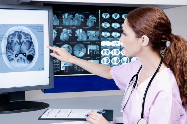 Od nihanja razpoloženja do glavobolov: 7 simptomov, ki lahko opozarjajo na možganski tumor