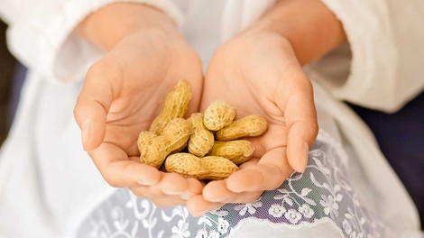 12 koristnih lastnosti arašidov za zdravje in lepoto