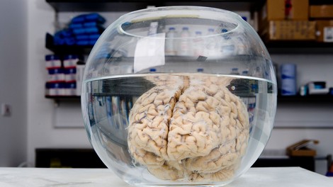 Miti o staranju možganov