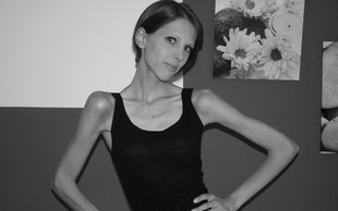 Špela Kranjec o 9-letnem boju z anoreksijo