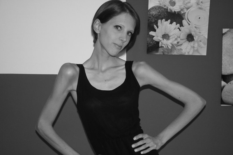 Špela Kranjec o 9-letnem boju z anoreksijo (foto: Arhiv www.notice-me.net)