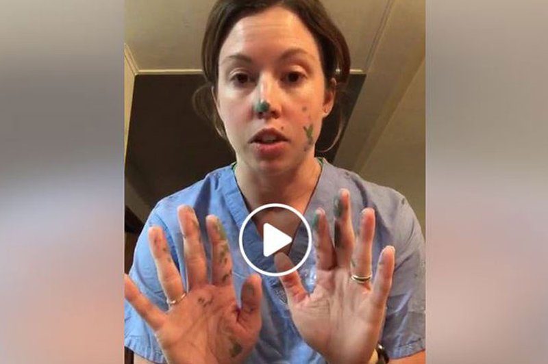 Medicinska sestra nazorno prikaže: Tako hitro lahko pride do prenosa virusa in okužbe! Ja, čeprav nosite rokavice … (VIDEO) (foto: Molly Lixey Facebook)