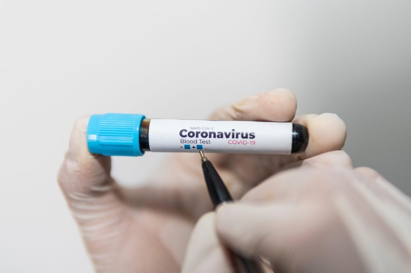 Znanstveniki: Krvna skupina lahko vpliva na potek covida-19! Imate krvno skupino A? (foto: profimedia)
