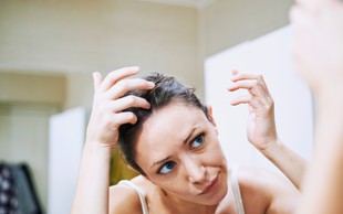 Če vas neprestano srbi lasišče in ste dobili prhljaj … Lahko gre tudi za luskavico in z zdravljenjem morate začeti ta trenutek!