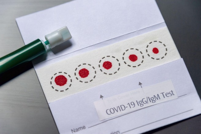 Hitri antigenski testi so manj zanesljivi od testov PCR. Kako natančni pa so slednji?