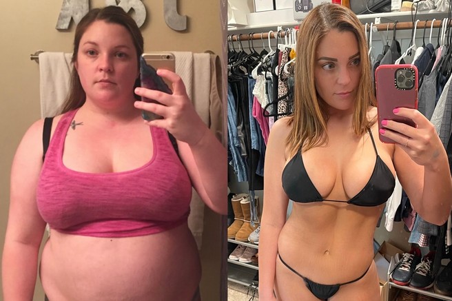 Kara je v treh letih izgubila 50 kilogramov. Obvod želodca ji je spremenil življenje