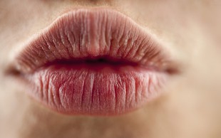 Kaj vam ustnice povedo o vašem zdravju?