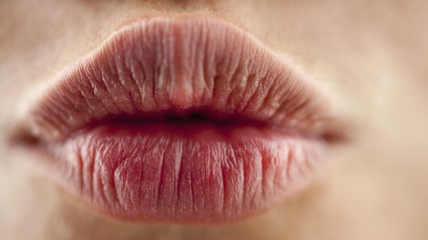 Kaj vam ustnice povedo o vašem zdravju?
