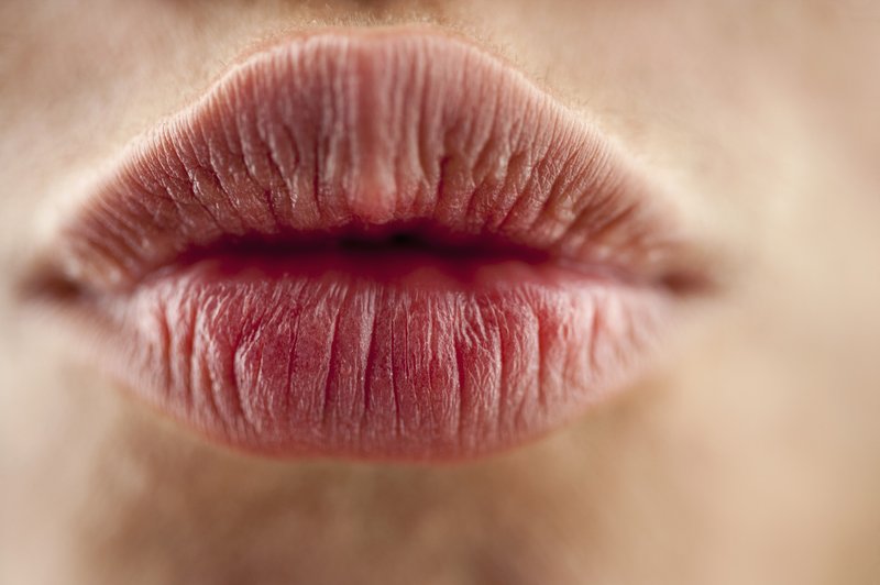 Kaj vam ustnice povedo o vašem zdravju? (foto: Profimedia)