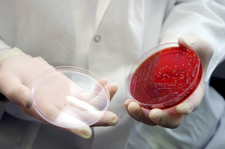 Raziskovalci so za poskus vzeli 80 različnih sevov bakterije E. coli in v raznolikih okoljih nadzorovali rast populacije. Bakterije so …