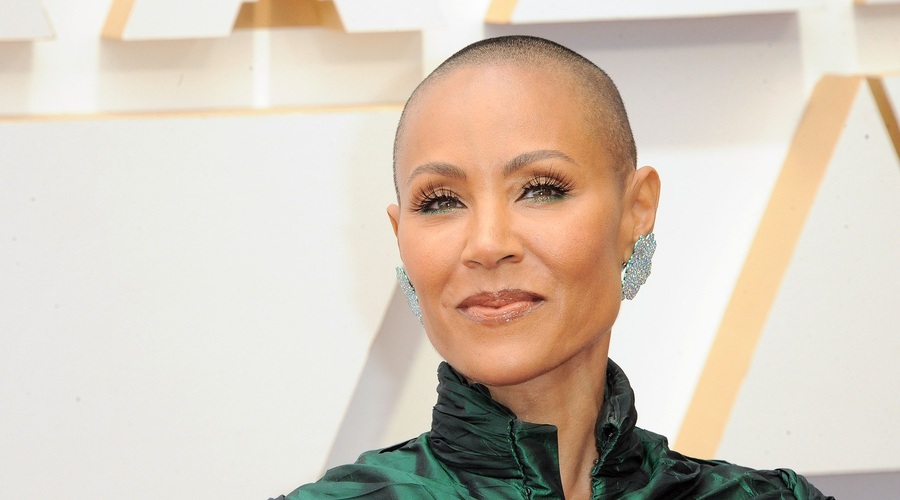 Jada Pinkett Smith je delila: To je bil prvi znak moje alopecije (foto: Profimedia)