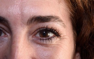 Če okoli svojih oči opazite gubice, vam morda primanjkuje TEGA antioksidanta
