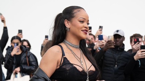 Rihanna je razkrila, kako skrbi za svojo kožo
