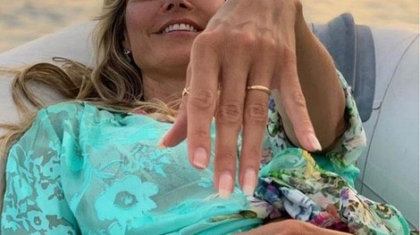 Je to konec simbola ljubezni: zakaj pari ne nosijo več poročnega prstana?