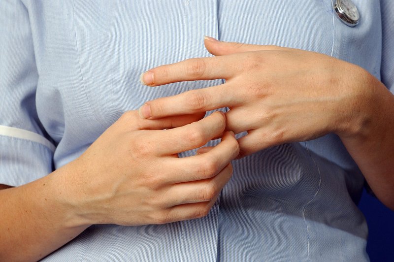 TO so zgodnji znaki artritisa, na katere morate biti pozorni! (foto: Profimedia)