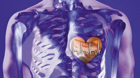 Zakaj pride do nenavadnega bitja srca? TO so najpogostejši vzroki!