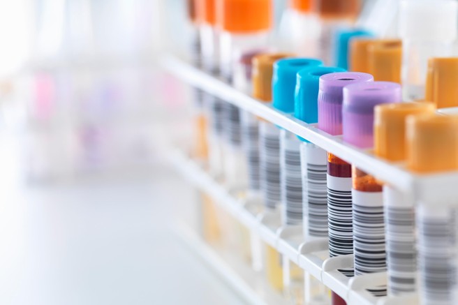 Kaj barva urina razkriva o vašem zdravju?