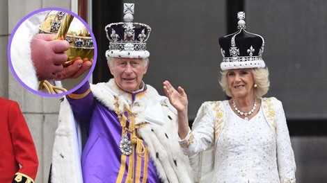 Kaj se dogaja s kraljem Charlesom?! Njegovi prsti so bili na dan kronanja grozno otečeni! (razlaga zdravnika)