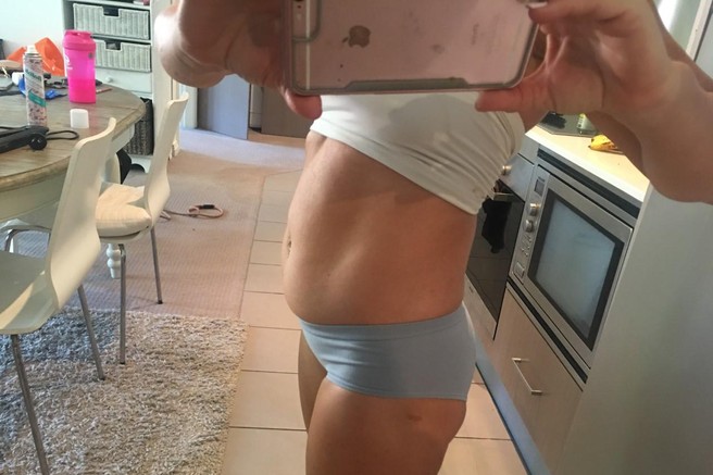 Vzrok napihnjenosti je lahko tudi ta hujša zdravstvena težava (nujno morate poznati simptome!)