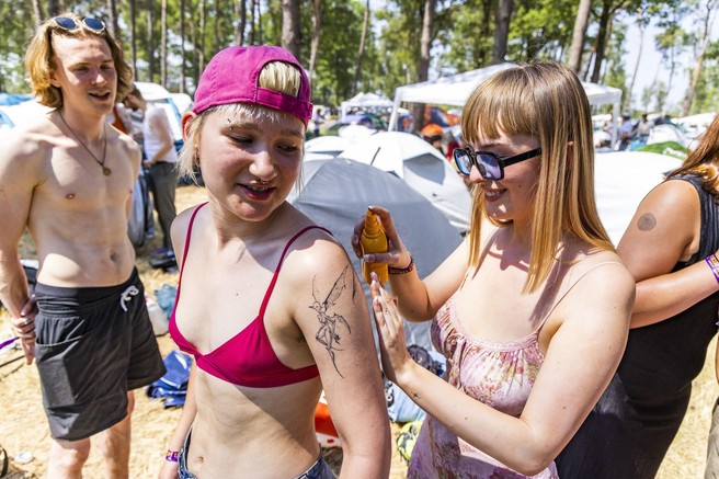 Tudi na teh nepričakovanih mestih morate nanesti sončno kremo!