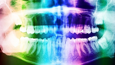 Leta 2030 bodo (s pomočjo zdravila) ljudem zrasli novi, tretji zobje, trdijo japonski znanstveniki