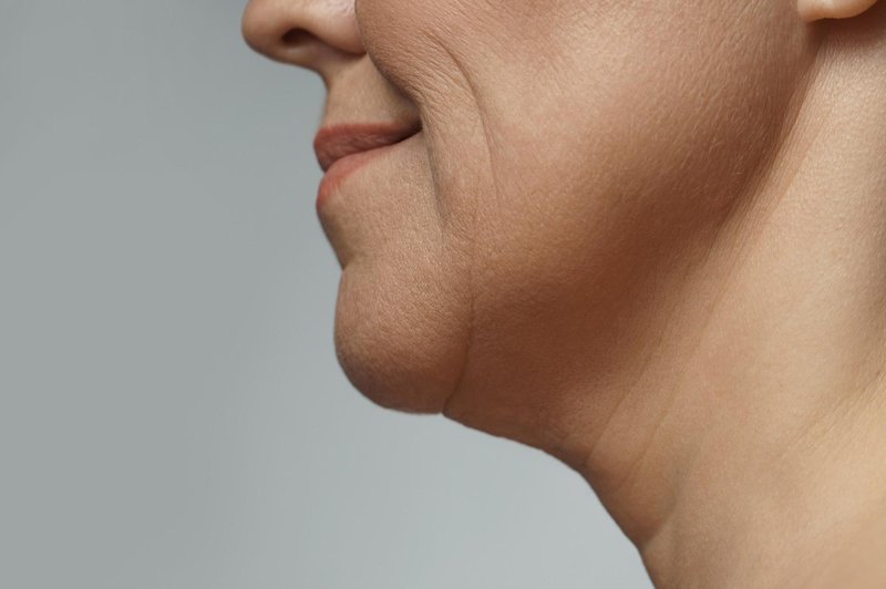 Tako se znebite gub in povešene kože na vratu (foto: Profimedia)