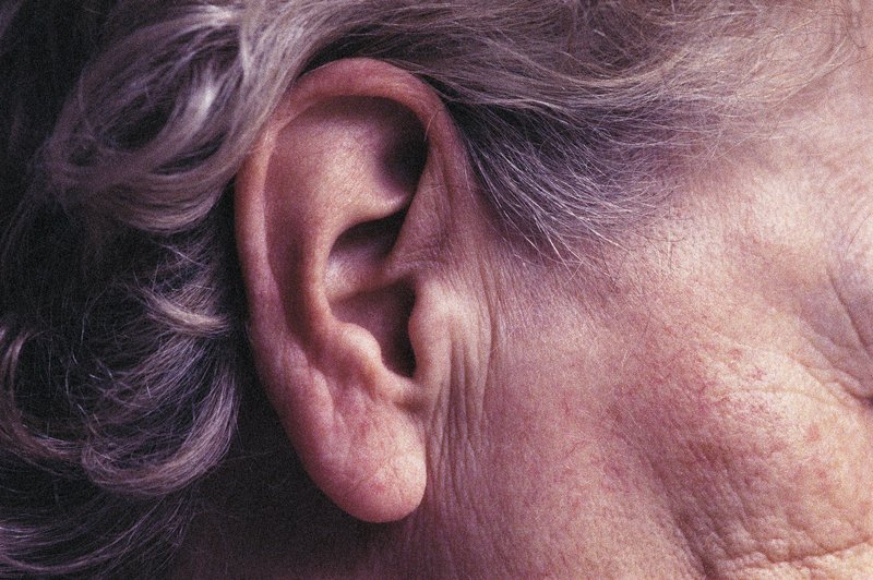 Zakaj se nam z leti povečajo ušesa? (foto: Profimedia)