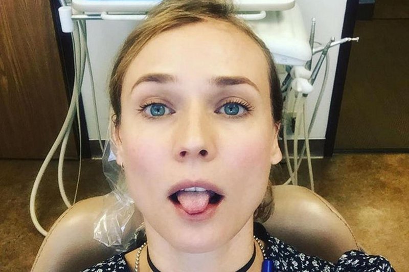 Zobozdravnik potrjuje: "Na pregledu lahko opazimo, ali je pacient pred kratkim imel oralni seks" (foto: Profimedia)